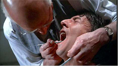 Dustin Hoffman having teeth drilled by sadistic dentist (Laurence Olivier) in "Marathon Man"
